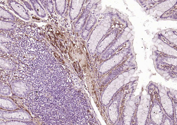 CALD1 antibody