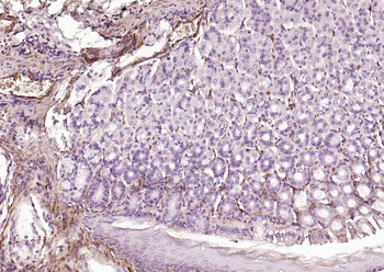 CALD1 antibody