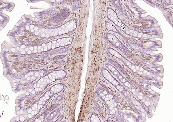 CALD1 antibody