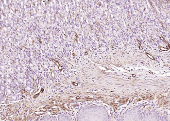 CALD1 antibody