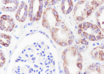 MTCO2 antibody