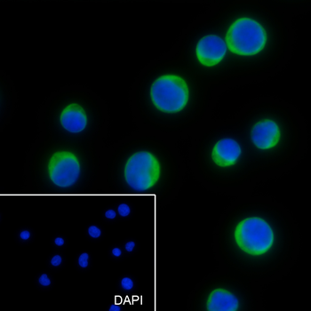 CD25 antibody