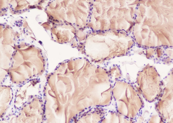 Thyroglobulin antibody