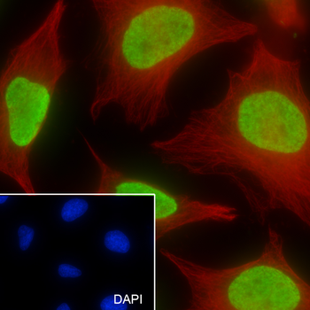 Mono-Methyl-Histone H3 (Lys23) antibody