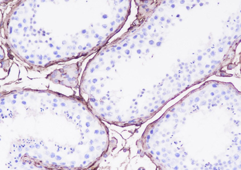 DPEP1 antibody