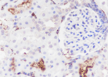 DPEP1 antibody