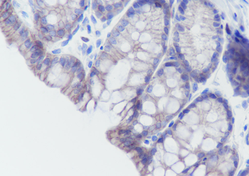 Cadherin-17 antibody