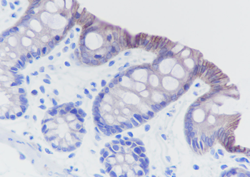 Cadherin-17 antibody