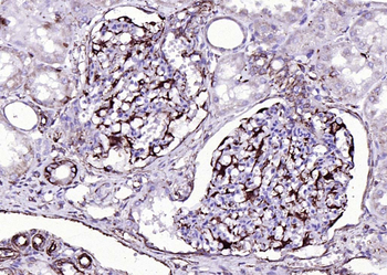 Vimentin antibody