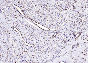 Vimentin antibody