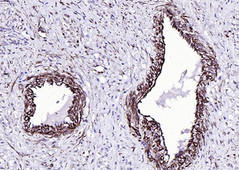 Vimentin antibody