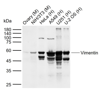 Vimentin antibody