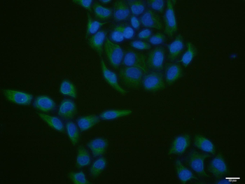 Vimentin antibody