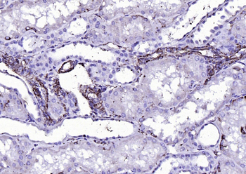 Vimentin antibody