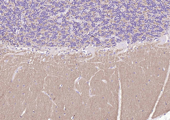 NCAM antibody