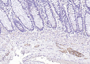 NCAM antibody