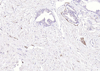 NCAM antibody