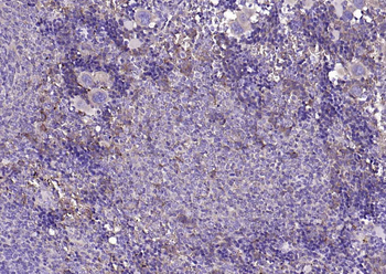 NCAM antibody