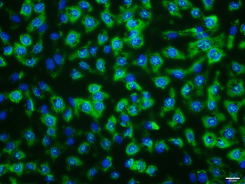 NCAM antibody