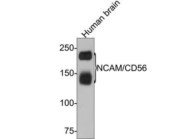 NCAM antibody