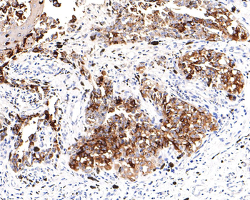 TYRP1 antibody