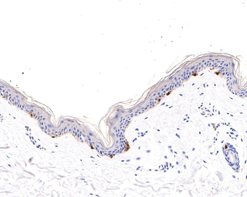 TYRP1 antibody