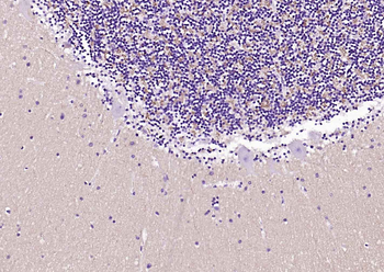 Alpha Synuclein antibody