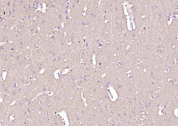 Alpha Synuclein antibody