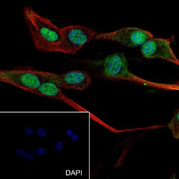 Alpha Synuclein antibody