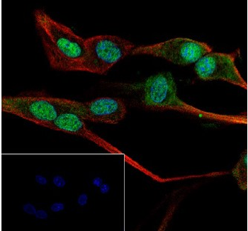 Alpha Synuclein antibody