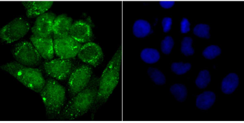 Alpha Synuclein antibody