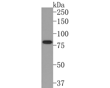 Periostin antibody