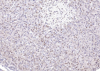 ESR2 antibody