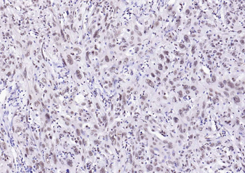 ESR2 antibody