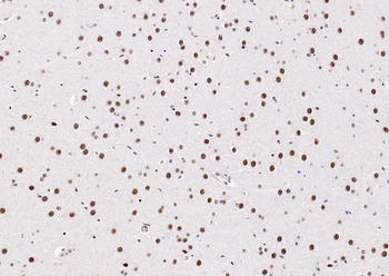 ESR2 antibody