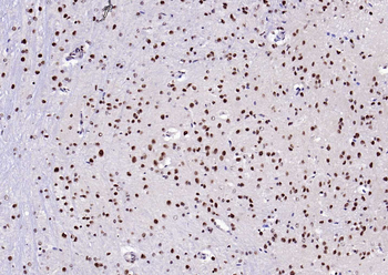 ESR2 antibody