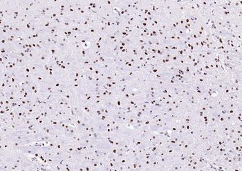 ESR2 antibody