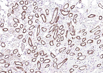 Osteocalcin antibody