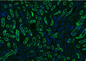 Osteocalcin antibody