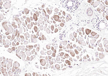 Osteocalcin antibody