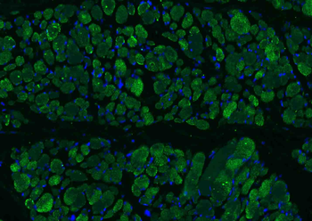 Osteocalcin antibody