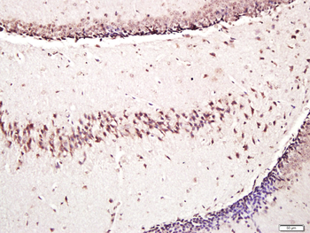 Osteocalcin antibody