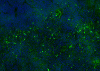 CD8B antibody