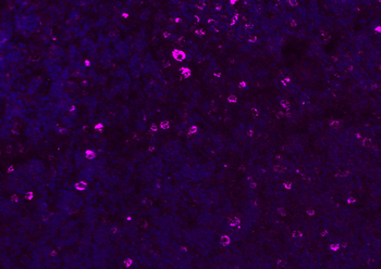 CD8B antibody