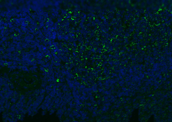 CD8B antibody