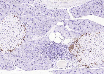 Goat Anti-Rabbit IgG H&L antibody (HRP)