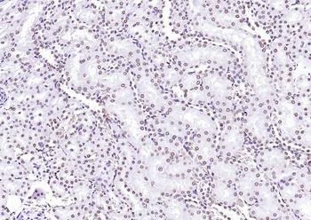 Goat Anti-Rabbit IgG H&L antibody (HRP)