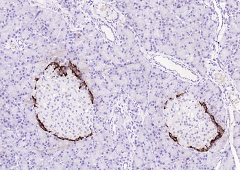 Goat Anti-Rabbit IgG H&L antibody (HRP)