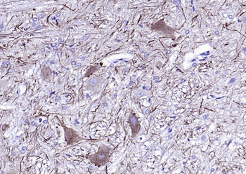 NF-L antibody