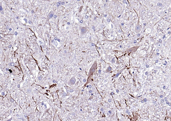 NF-L antibody